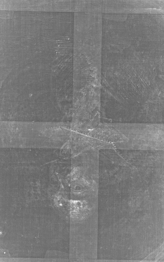 Ｘ光攝影旋轉180°